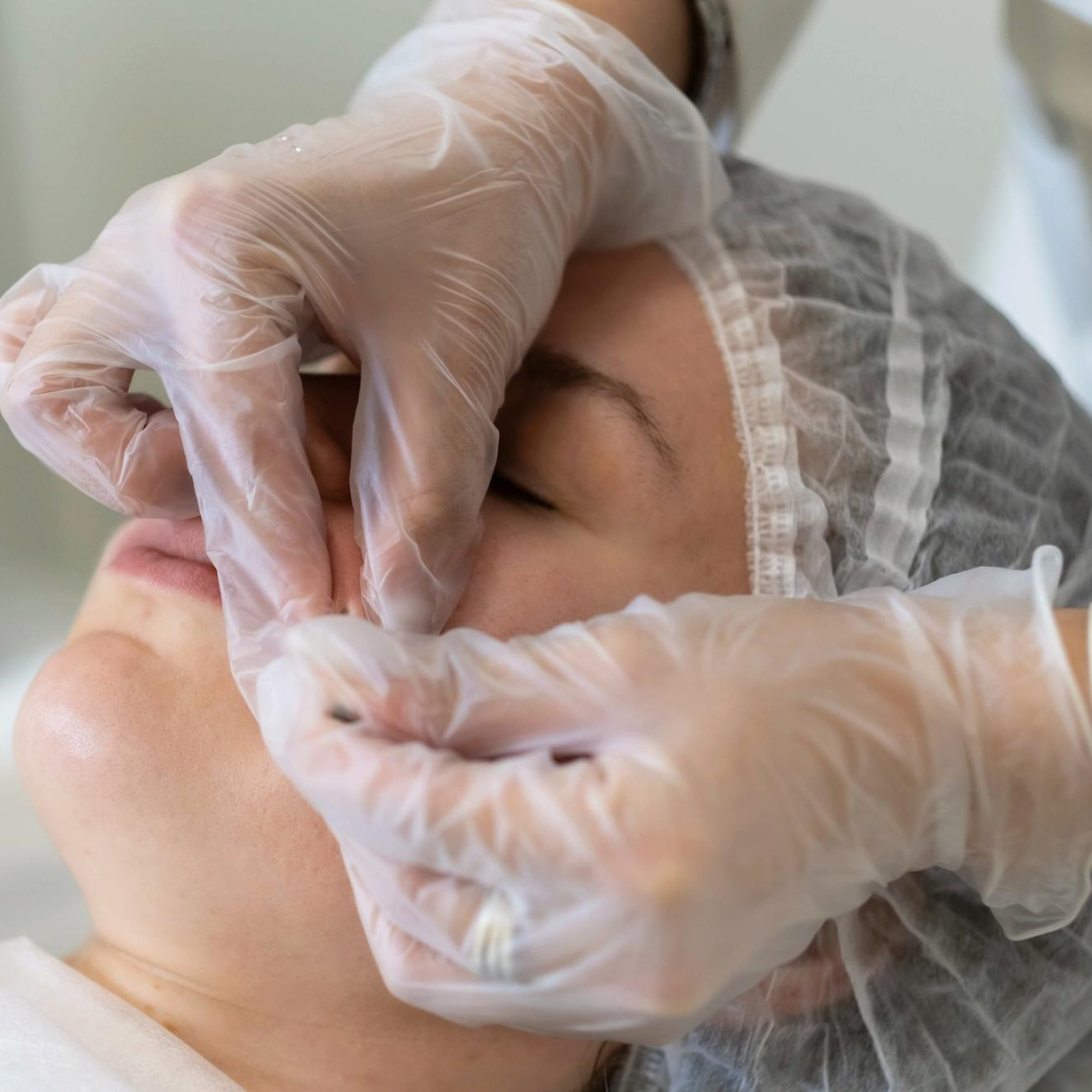 A patient undergoes minimally invasive surgery as part of her facial rejuvenation in Bethesda, MD.